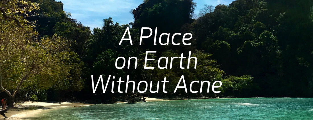 A Place on Earth Without Acne