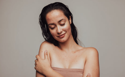 The Menstrual Cycle and Acne: Understanding the Skin’s Journey through Each Phase