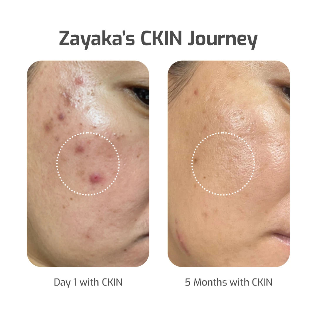 The Skinfulness Daily Self-Care Kit