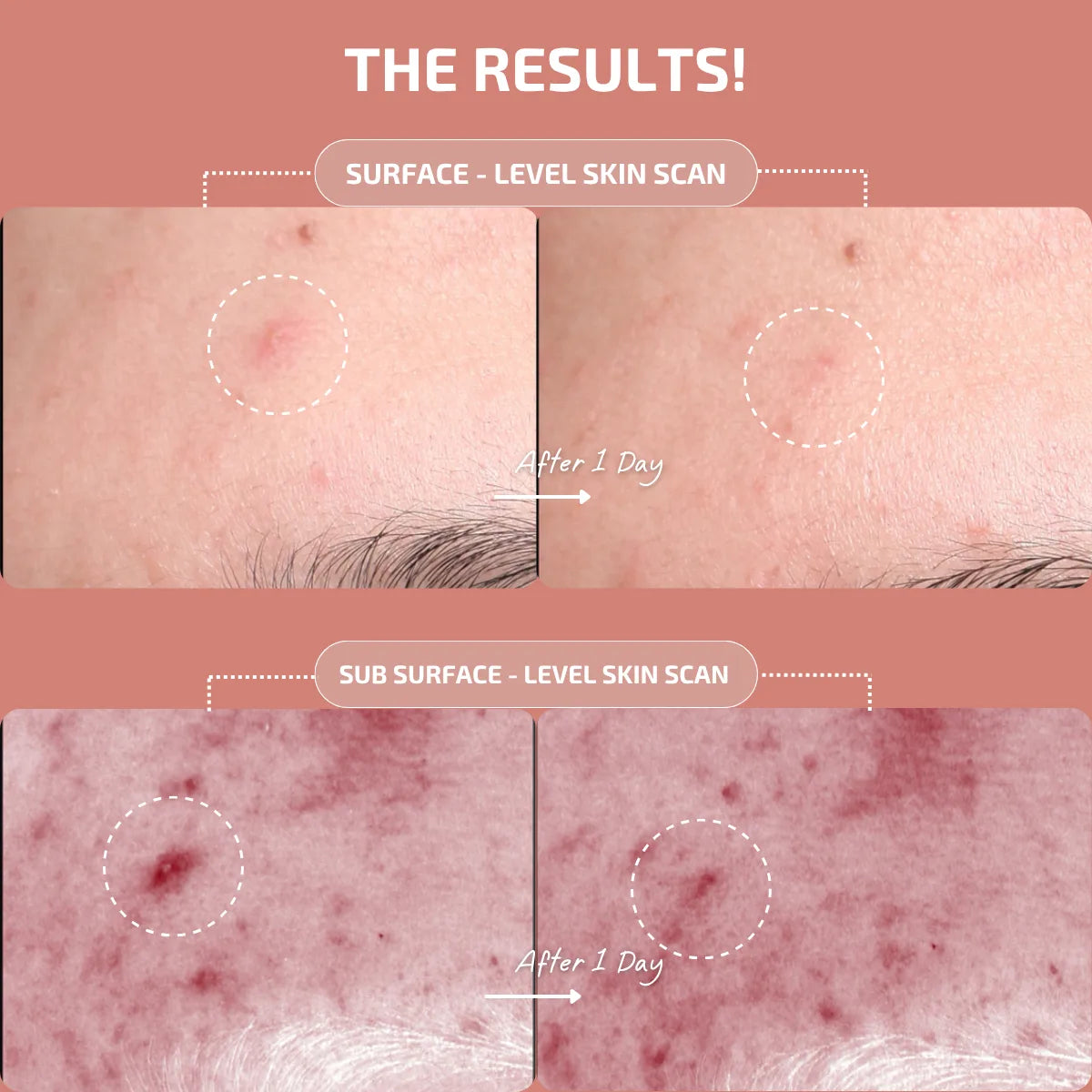 Advanced Blemish Patch